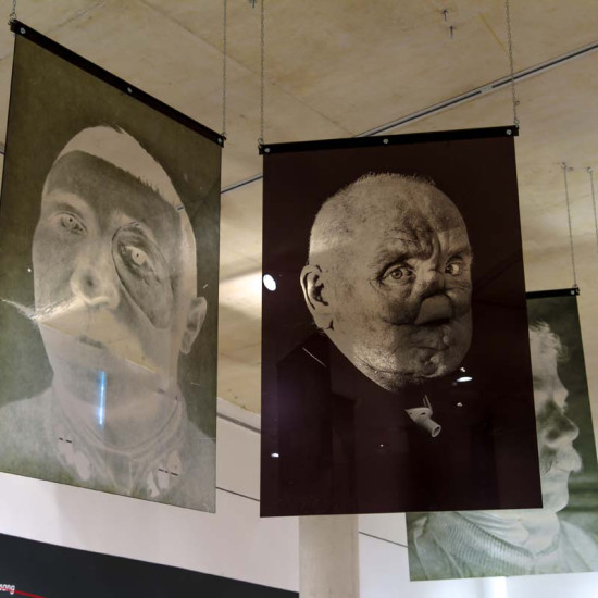 image du projet Face à face (regards sur la défiguration)